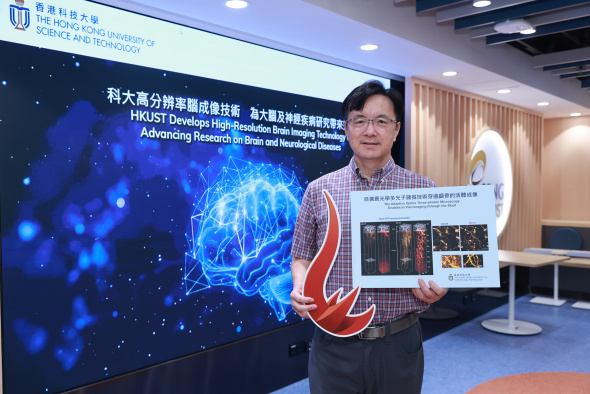 由科大工学院电子及计算机工程学系教授瞿佳男教授领导的研究团队开发了一项崭新技术，以近乎无创方式对清醒状态下的实验小鼠大脑进行高分辨率图像扫描，未来将有助探索人类脑部在健康和疾病状态下的运作。 