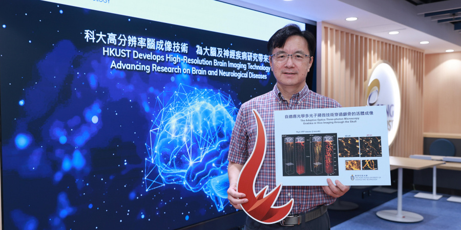 由科大工学院电子及计算机工程学系教授瞿佳男教授领导的研究团队开发了一项崭新技术，以近乎无创方式对清醒状态下的实验小鼠大脑进行高分辨率图像扫描，未来将有助探索人类脑部在健康和疾病状态下的运作。 