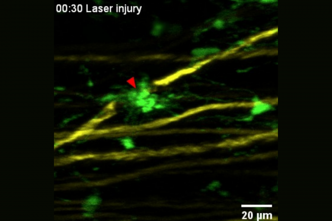 An axon (colored in yellow) is cut off by an ultrafast pulse laser (marked by red arrow) and it shows that the immune cells (colored in green) react quickly and come up to the injury site.