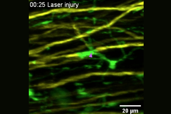 The immune cells quickly wrap up the node of Ranvier (marked by a purple arrow) at certain distance away from the injured site and stop the further degeneration of axon.