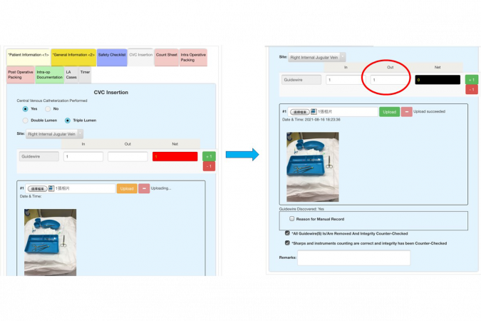 人工智能系統實時核對醫護人員點算導線的結果（圈中所示）。
