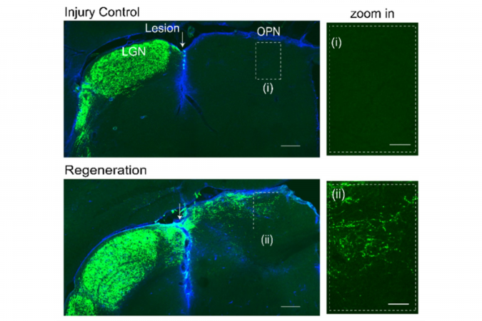 Regenerated axons cross the injury site and reinnervate the target brain region OPN.