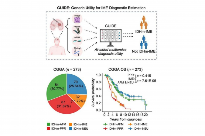 GUIDE: An AI-powered tool for glioma diagnosis