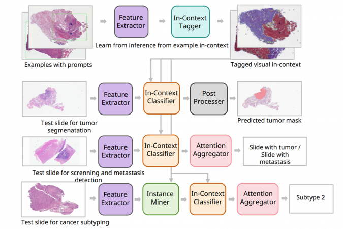 PRET系統可一站式支援癌症篩檢、腫瘤分型、腫瘤分割、淋巴結轉移檢測等多種病理診斷任務。