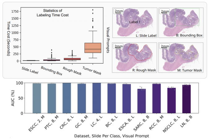 PRET 系統設有靈活的視覺提示系統，支援切片標籤、邊界框、粗略的掩碼和精準的掩碼四種提示類型，適配不同的標註成本，以取得理想診斷效果。