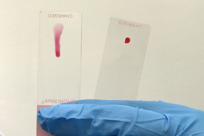 The new hydrogel changes from solid (right) to liquid state upon light exposure.