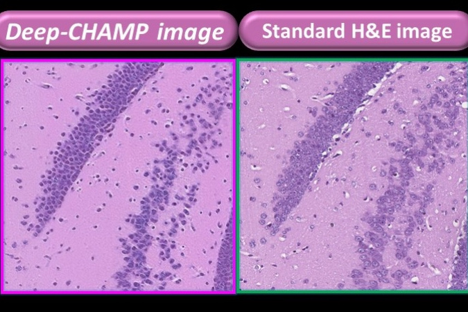 Comparison of the tissue images presented by the microscope developed by PhoMedics (left) and the FFPE tissue (right) – existing gold standard methodology for cancer cell imaging. The former can be displayed within three minutes while the latter takes about a week.